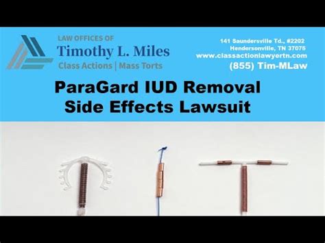  All contraceptive methods have side effects. . Paragard removal side effects reddit